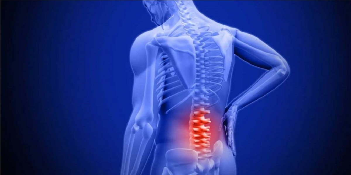 فیزیوتراپی زانو بعد از عمل acl